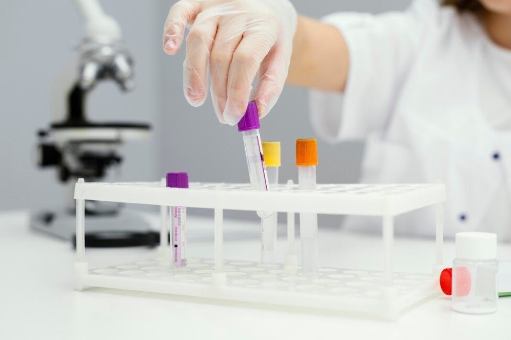 Strep Test