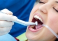 Tooth Extraction