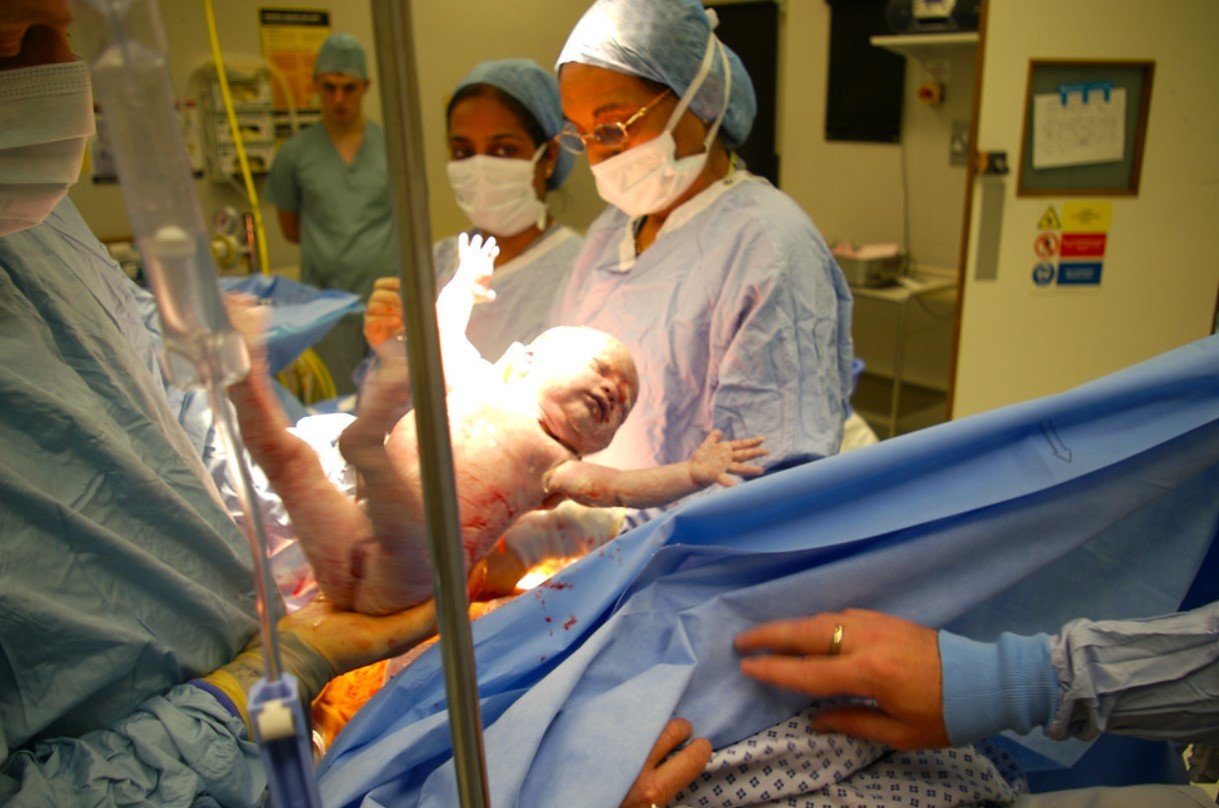 C-Section