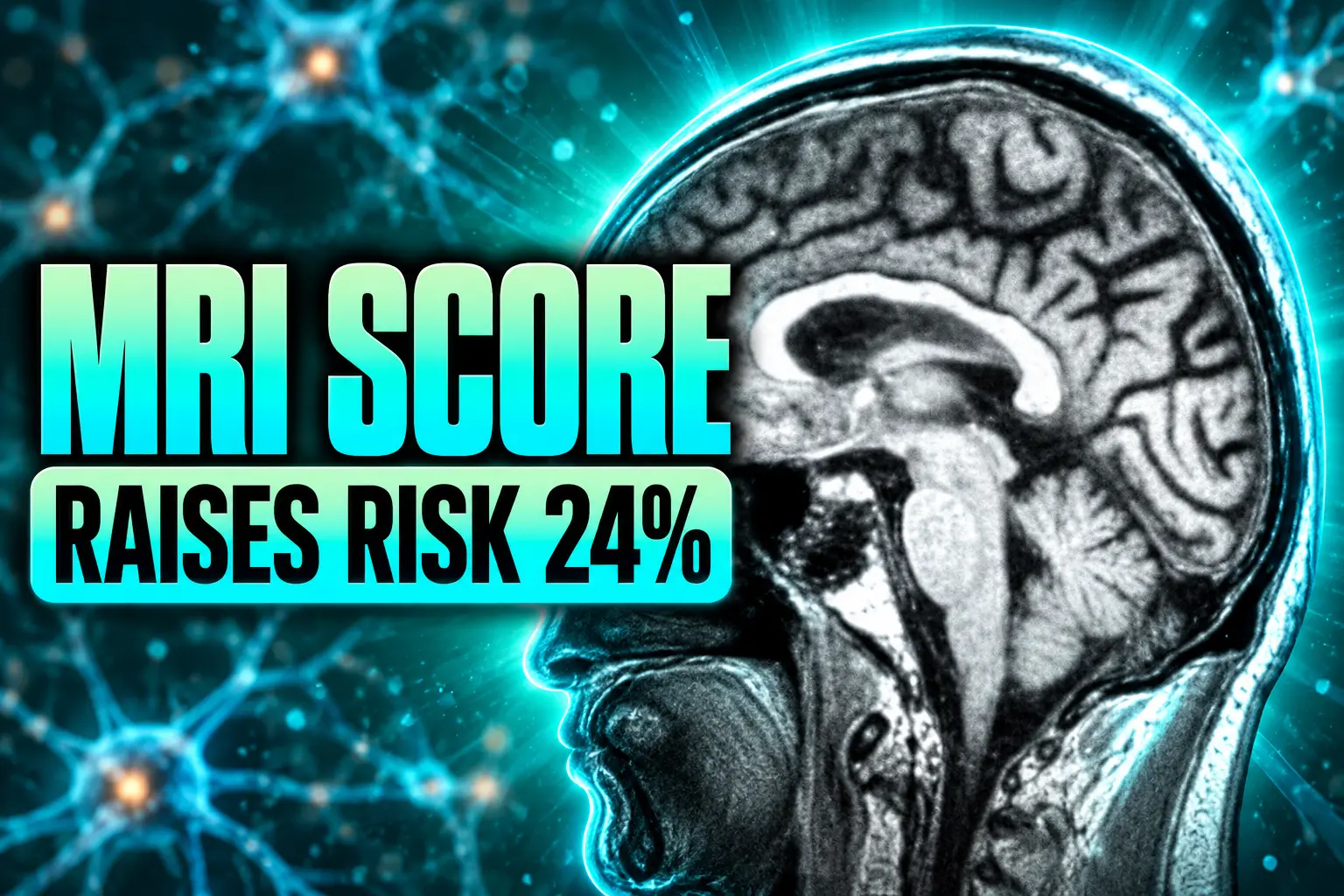 MRI score raises dementia risk 24 percent early-onset