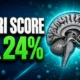 MRI shrinkage score early-onset Alzheimer’s 24 percent risk
