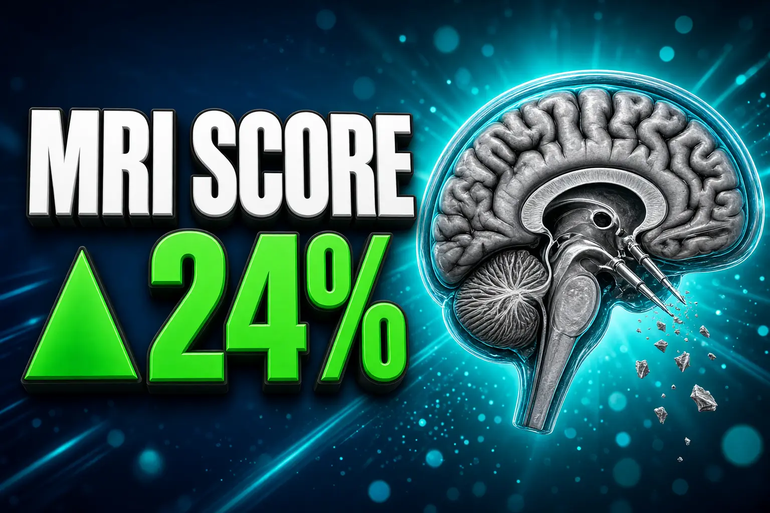 MRI shrinkage score early-onset Alzheimer’s 24 percent risk