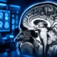 Early-onset Alzheimer MRI score 24 percent dementia risk