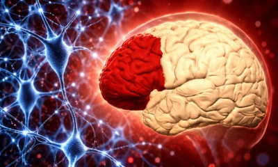 PsychAD atlas 6.3 million prefrontal brain cells